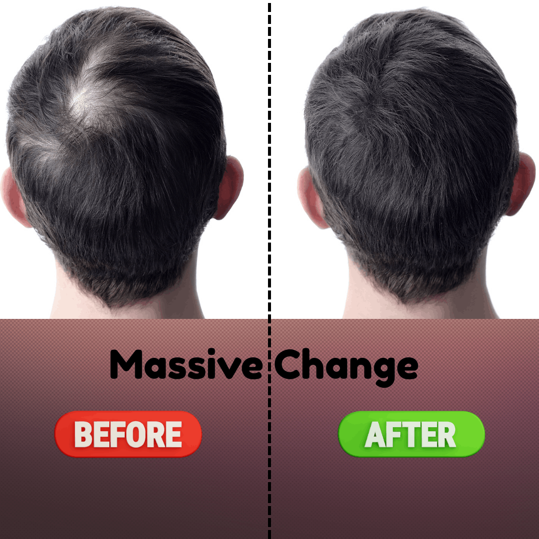 Before and after comparison of hair growth on a person's head.