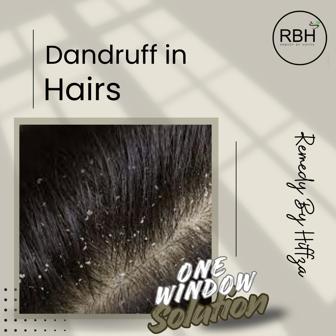 Image of dandruff in hair with text 'Dandruff in Hairs' and 'One Window Solution' on a patterned background.