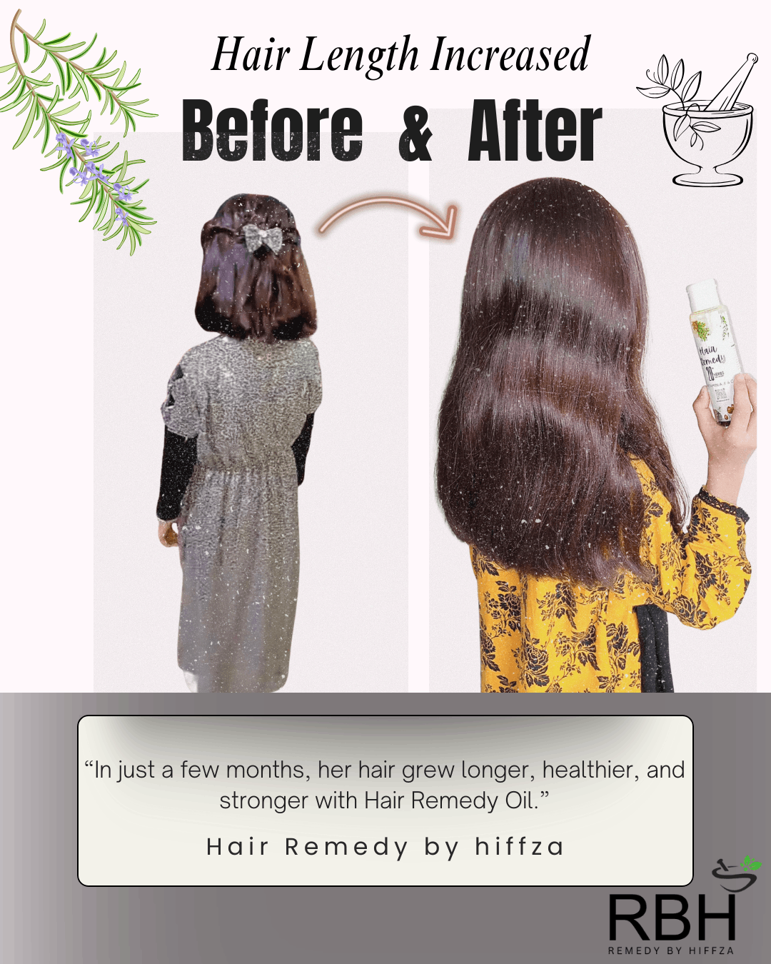 Before and after comparison of hair length increase using Hair Remedy Oil by Hifzza.