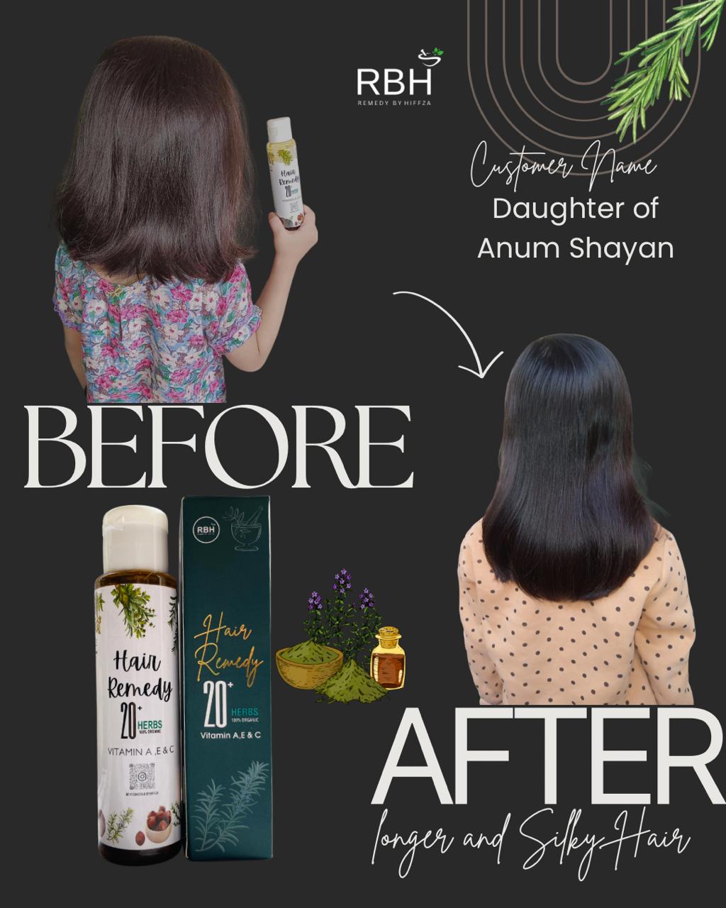 Before and after comparison of hair growth with RBH Hair Remedy products on a dark background.